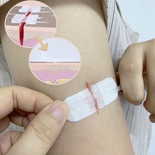 Vendajes adhesivos para cierres de heridas de emergencia, calcomanías de puntada con cremallera para camping, supervivencia y equipo doméstico, 3 disponible en Yaxa Peru