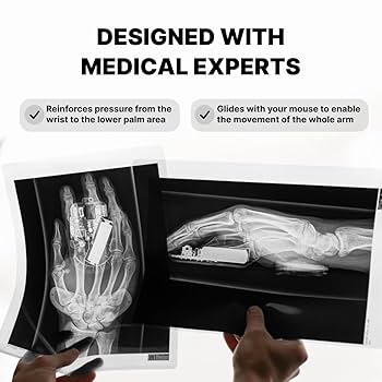 Amazon.co.jp：DELTAHUB Carpio 2.0 マウス用 可動式