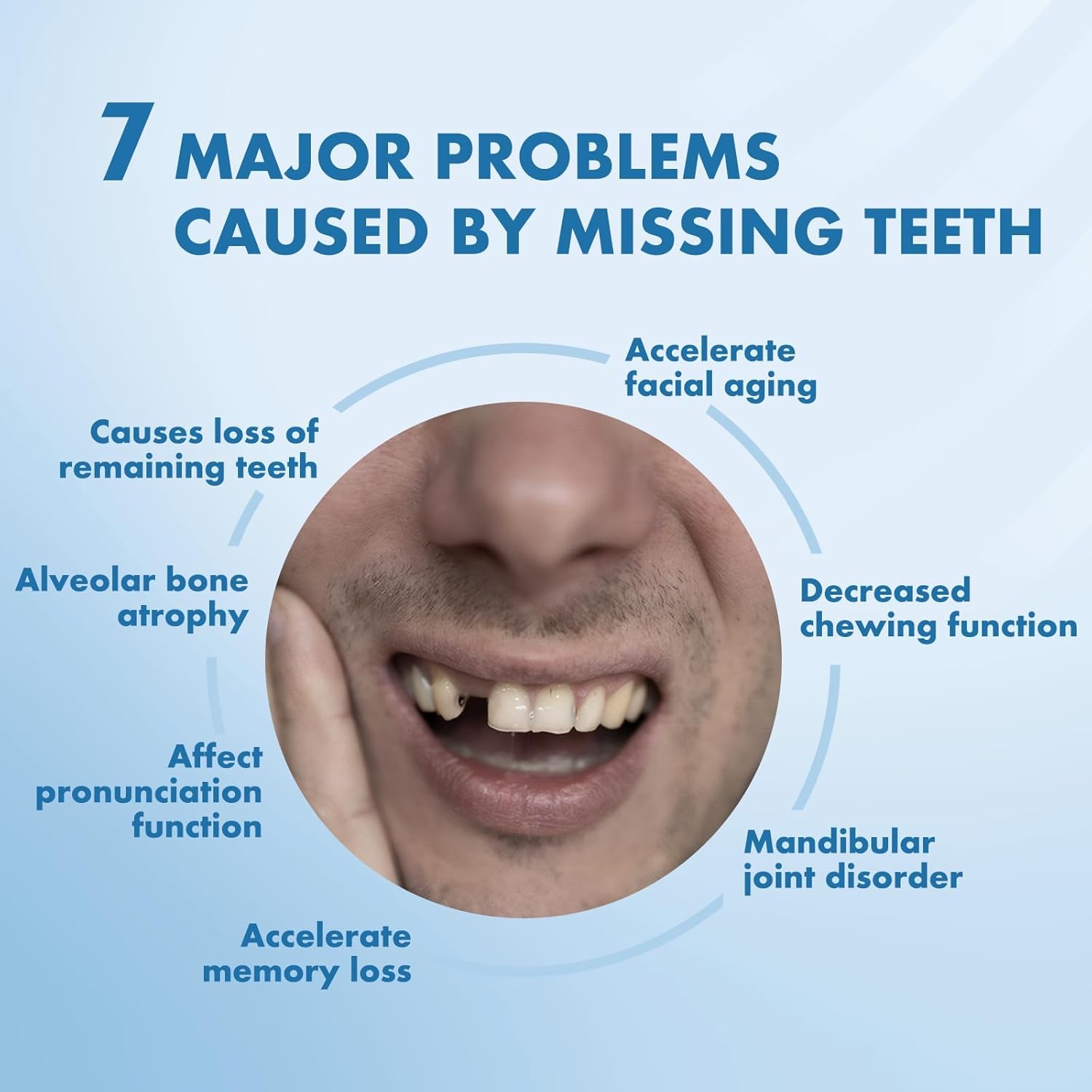 Partial Dentures - Custom Removable Personalized Tooth Replacement Set for Missing Teeth & Gap (3 Teeth)