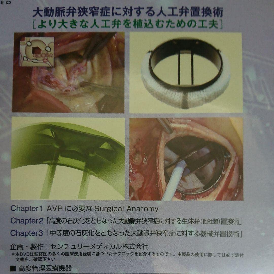 Amazon.co.jp: 大動脈弁狭窄症に対する人工弁置換術 DVD より大きな 