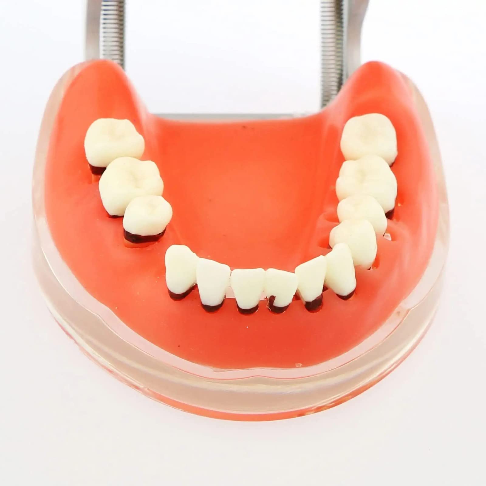 Modello Denti per Malattia Parodontale per Studio Odontoiatrico, Typodont con Gomme Morbide per Insegnamento e Formazione in Odontoiatria, Strumento Educativo Anatomico