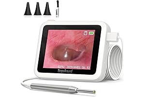 ScopeAround Otoscope Ear Camera: Your Home Ear Inspection Pro