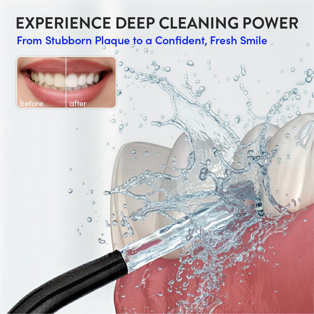 Éclat Irrigador dental eléctrico portátil impermeable para limpieza profunda de dientes, doble tanque de 320 ml, recargable por USB-C, carga de 30 días, 4 accesorios incluidos sin BPA (negro)
