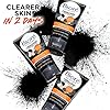 BiorÃ© Charcoal Acne Face Scrub, with 1% Salicylic Acid and Natural Charcoal, Helps Prevent Breakouts and Absorb Oil for Deep Pore Cleansing, 4.5 Ounce (HSA/FSA Approved)