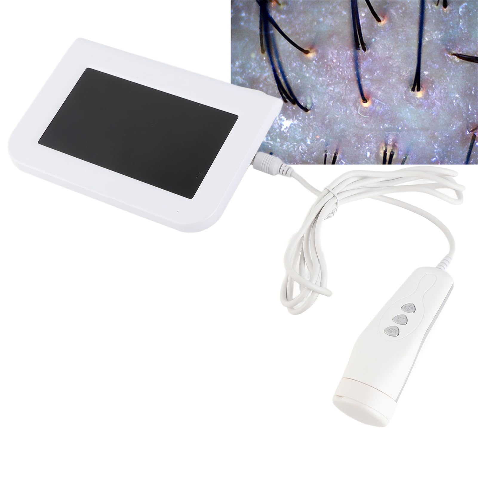 Hautdiagnose-Haaranalysator, 7-Zoll-LCD-Bildschirm, Ladetyp, Kopfhaut, Haarfollikel, Haut, Haardetektor, Analysegerät, Professioneller Hautöl-Feuchtigkeits-Vergrößerungstester, 100-240 V(EU)
