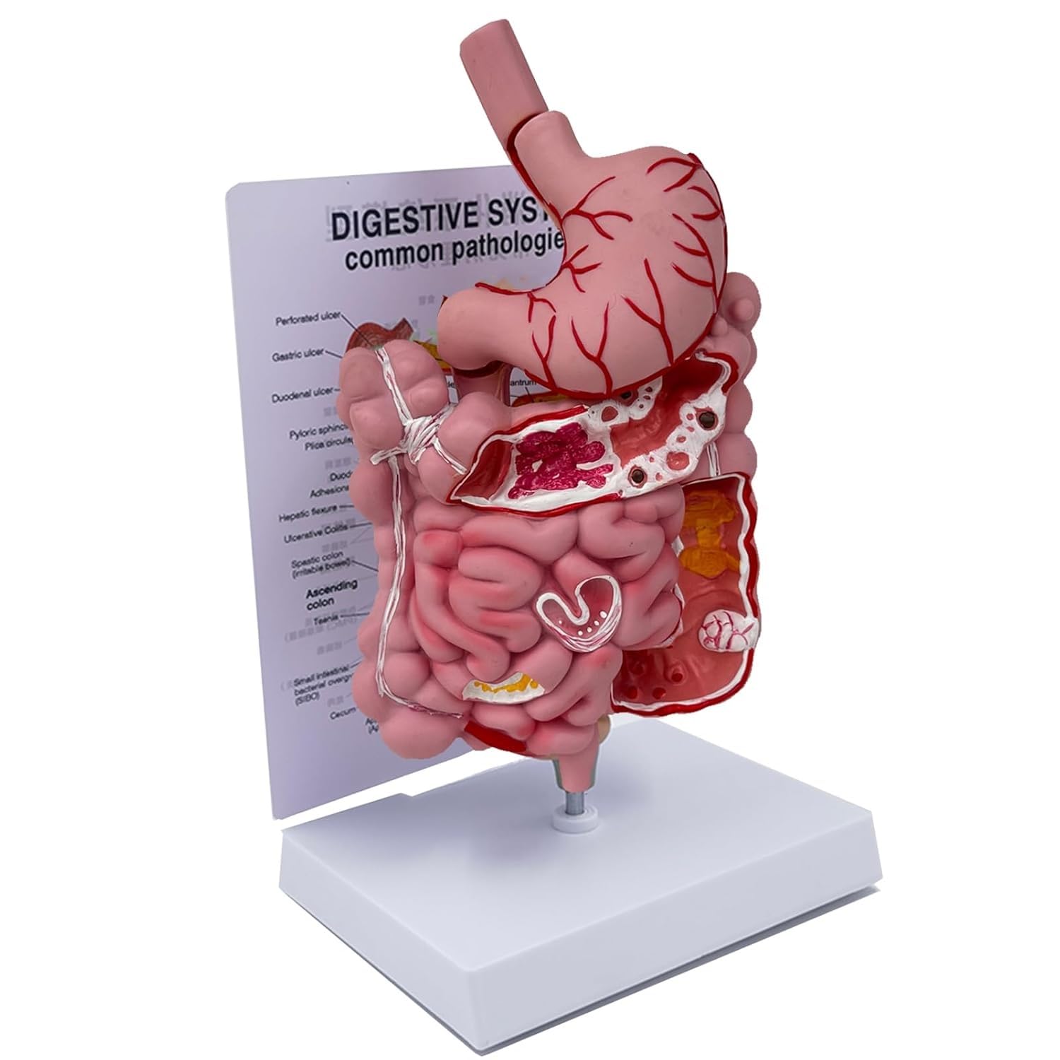 Model układu pokarmowego człowieka, model dydaktyczny przekroju żołądka, wyjmowany model anatomii ludzkiego żołądka, obejmuje przewód pokarmowy i okrężnicę, odpowiedni do wspomaganej nauki.