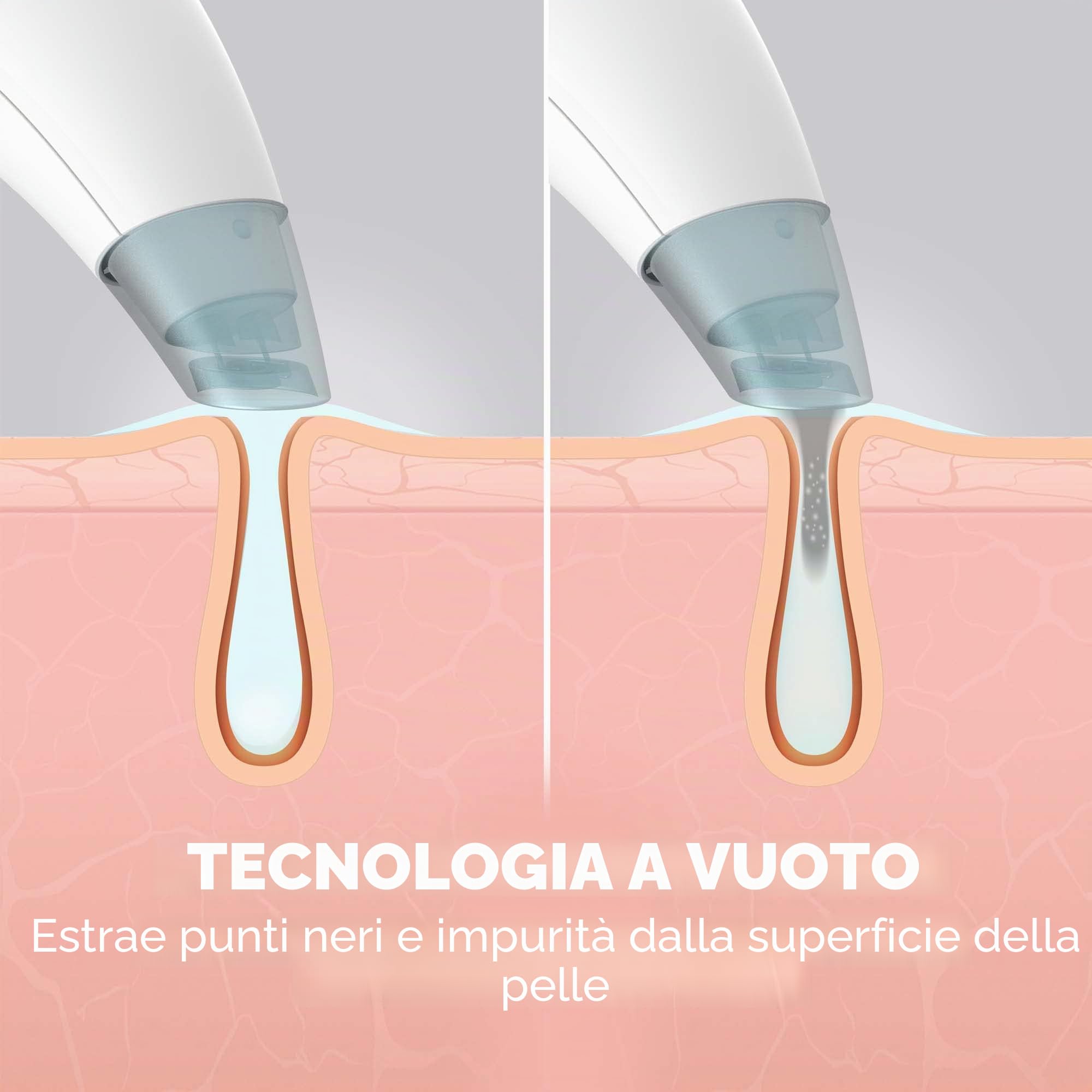 Homedics Refresh Hydradermabrasion Cleanser Viso, Macchina Hydrafacial | Per la Pulizia e Rimozione delle Imperfezioni, 3 Programmi, 6 Ugelli, per Pelle Impura