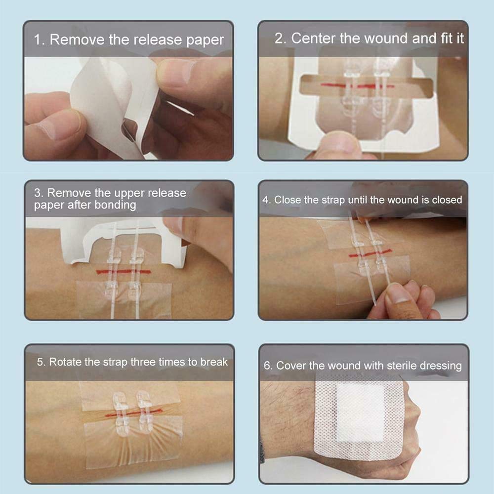 Buy Zipper Bandaid SutureFree, Zip Stitch Wound Closure kit, Surgical