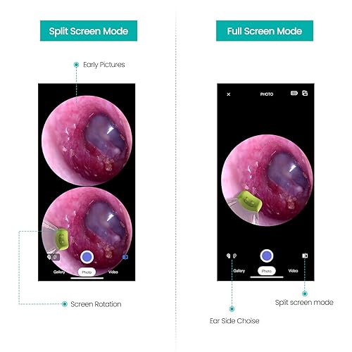 Miniatura 4 de ScopeAround Otoscopio con luz, cámara de oído con doble vista, alcance de oído WiFi de 720pHD con 6 luces LED, cámara otoscopio de lente de 0.154 in