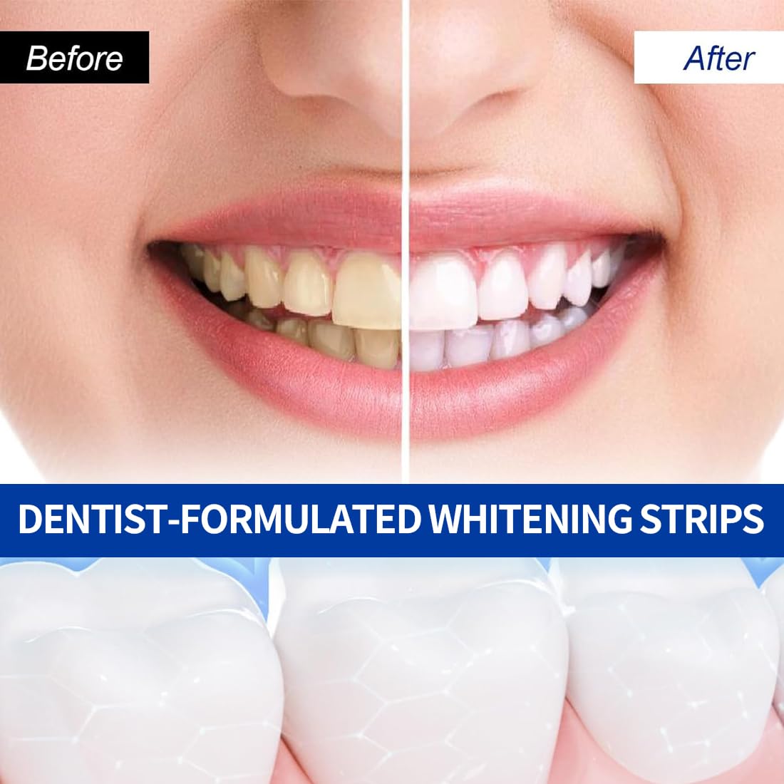 Strisce Sbiancanti Denti Professionale - 28 Strips Whitening per Sbiancamento,strisce sbiancanti denti, Delicate e Rapide, Rimuove le Macchie Profonde-A