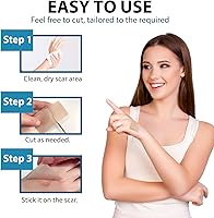 Vista 5 de Cinta de silicona para cicatrices (rollo de 1.6 x 60 pulgadas, rollo de 4.9 ft), hojas de cicatriz de silicona médica, tiras, cicatrices, hojas