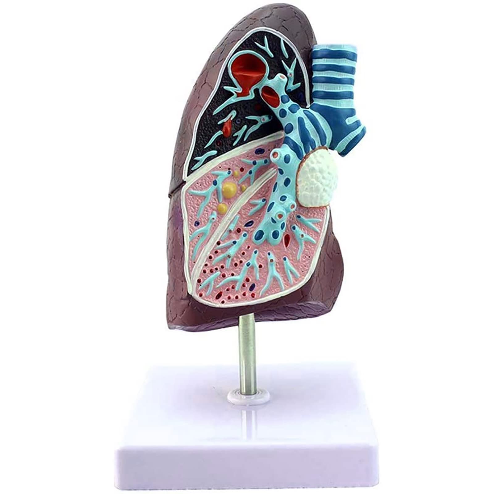 Buy Human Lung Model, Human Anatomical Lung Pathology Anatomy Medical Model, Simulation
