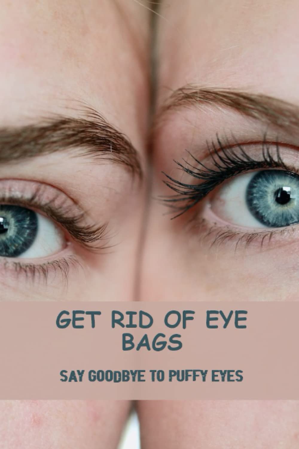 Get Rid Of Eye Bags: Say Goodbye To Puffy Eyes