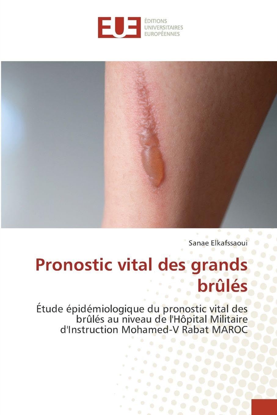 Pronostic vital des grands brûlés: Étude épidémiologique du pronostic vital des brûlés au niveau de l'Hôpital Militaire d'Instruction Mohamed-V Rabat MAROC