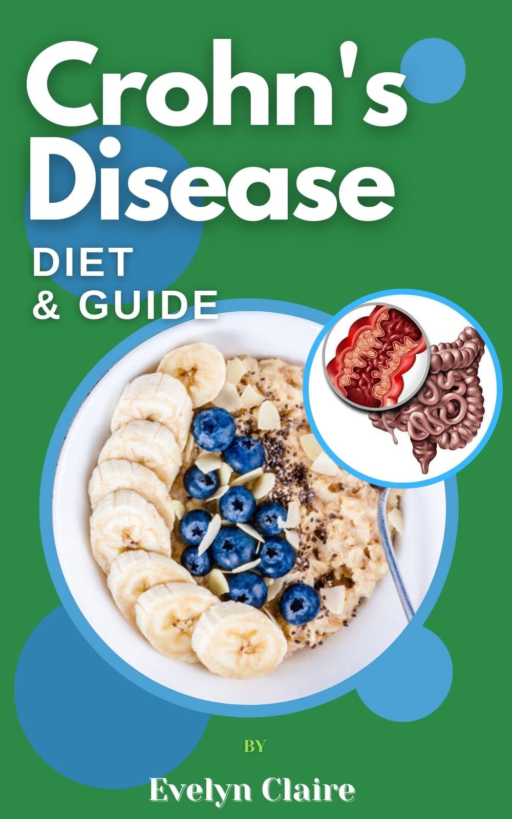 Crohn's Disease Diet & Guide: A Comprehensive Diet & Guide Cookbook With More Than 40 Easy Recipes and 25 Essential Cooking Tips For Crohn's Patients To Start Feeling Better Every Day.