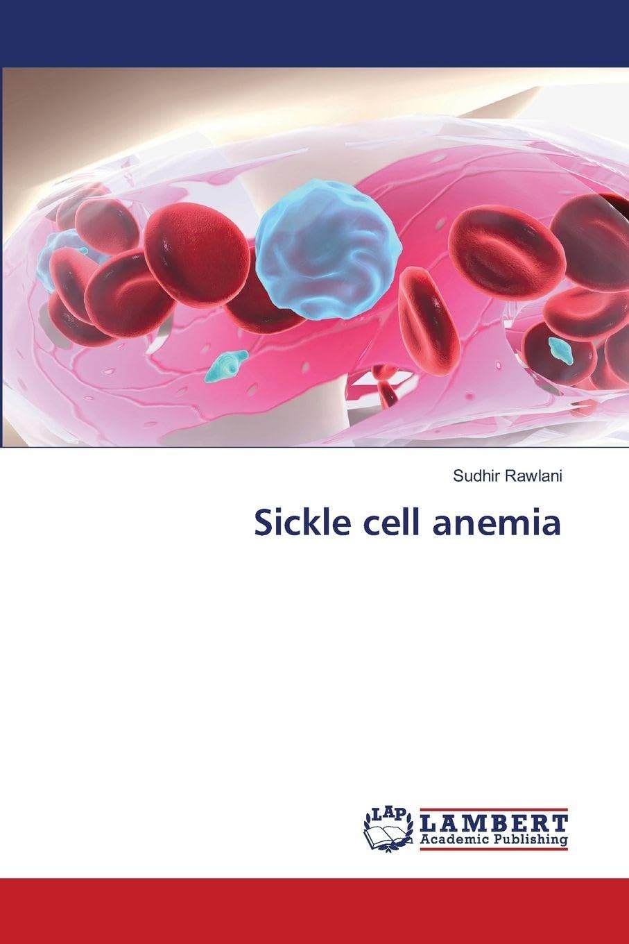 Sickle cell anemia