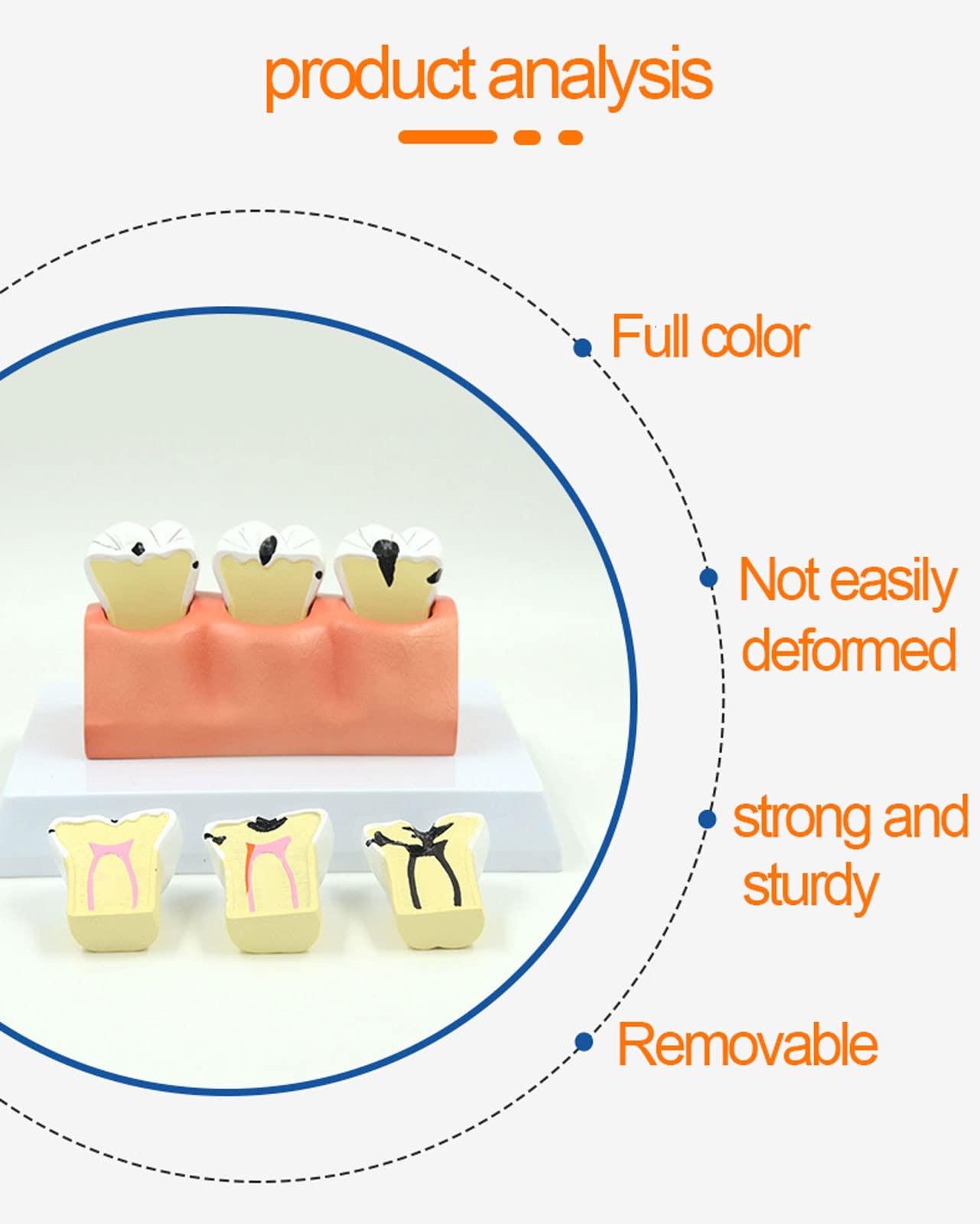歯牙模型　3種類　別売り可 SRP実習用顎模型 [P15FE-500HPRO-S2B1-GSD]｜株式会社ニッシン｜歯科