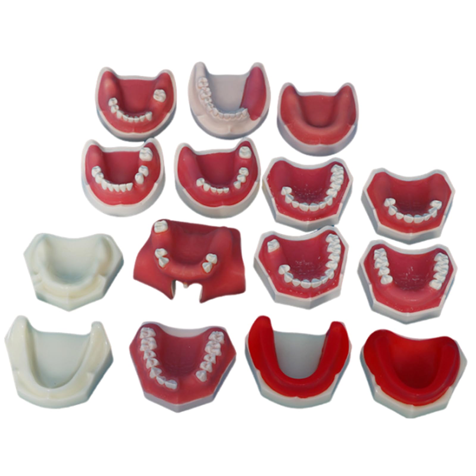 Modello di impianto Dentale - Modello di impianto mandibolare Medico e odontoiatrico - per Studio didattico Displaymedical Model,A14-8cm