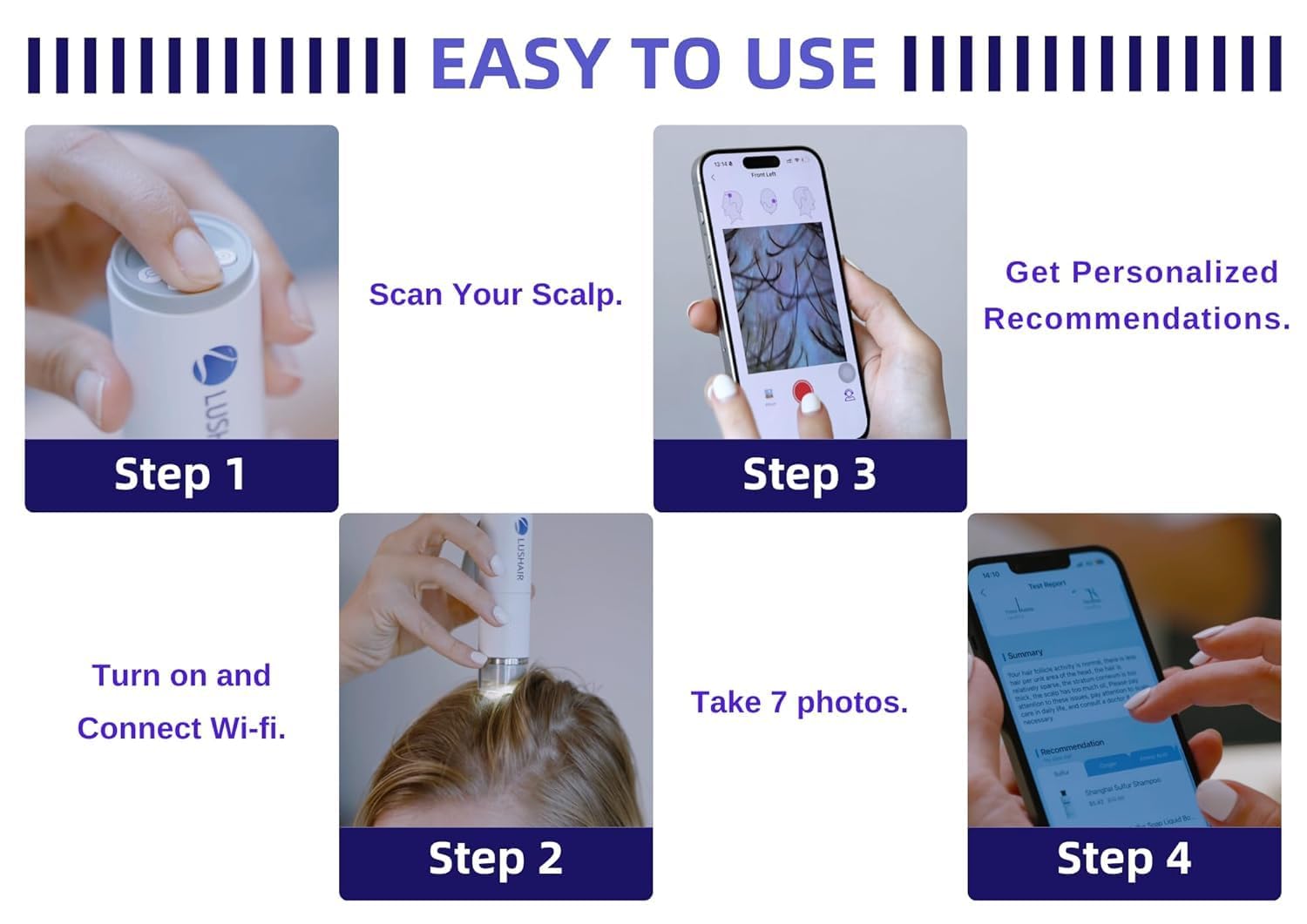 Lushair ハンドヘルド頭皮カメラ lushair Wireless Hair Analyzer, Hair Follicle Tester, Scalp