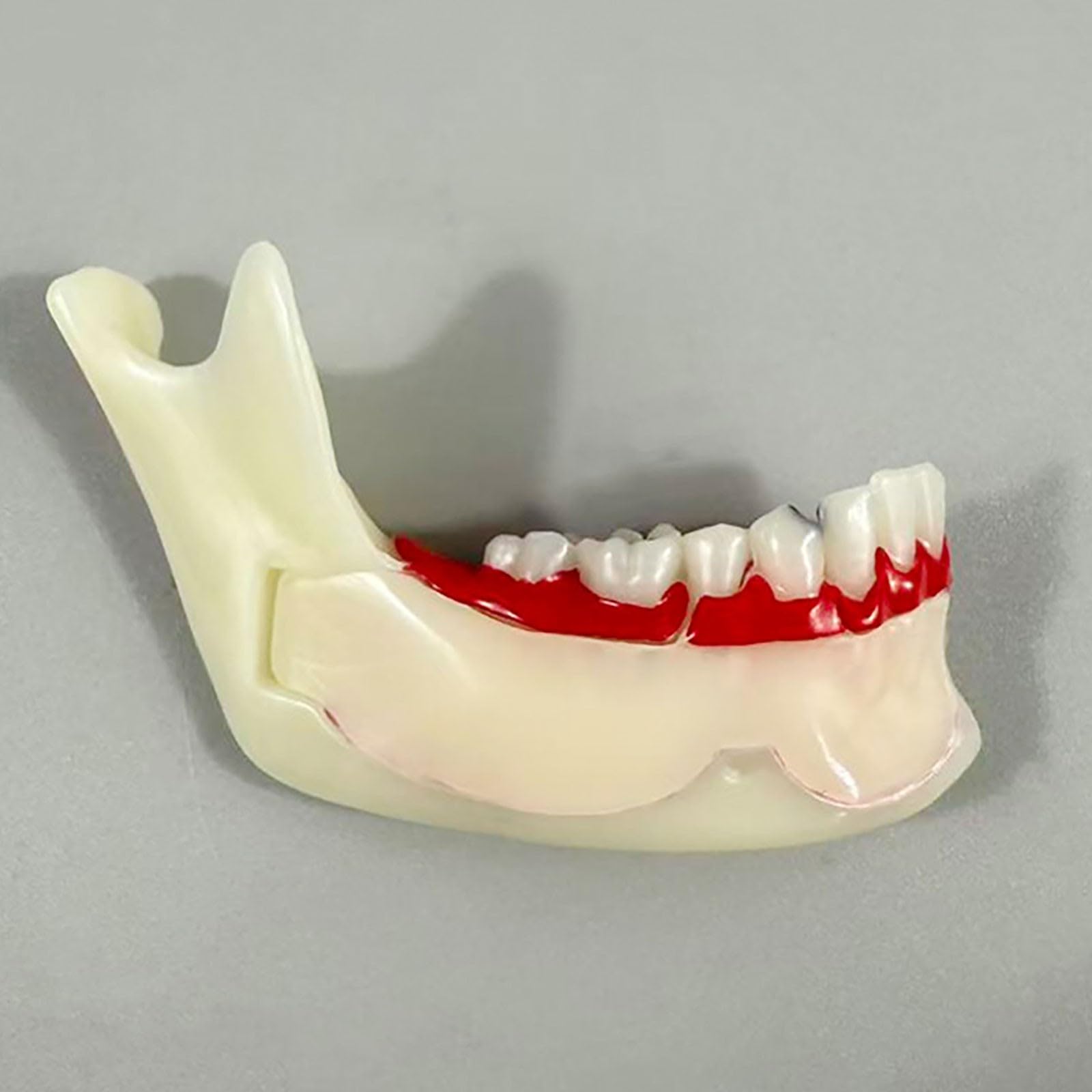 Modello di denti Typodont per l'educazione orale, strumento dimostrativo per lo studio della carie e della cisti radicale, aiuto didattico anatomico per dentisti