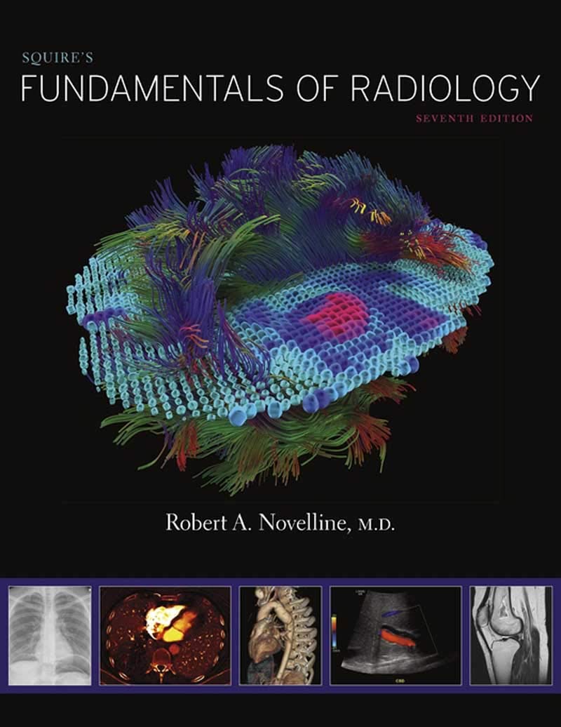 Squire’s Fundamentals of Radiology Seventh Edition 9780674057951 Medicine & Health Science