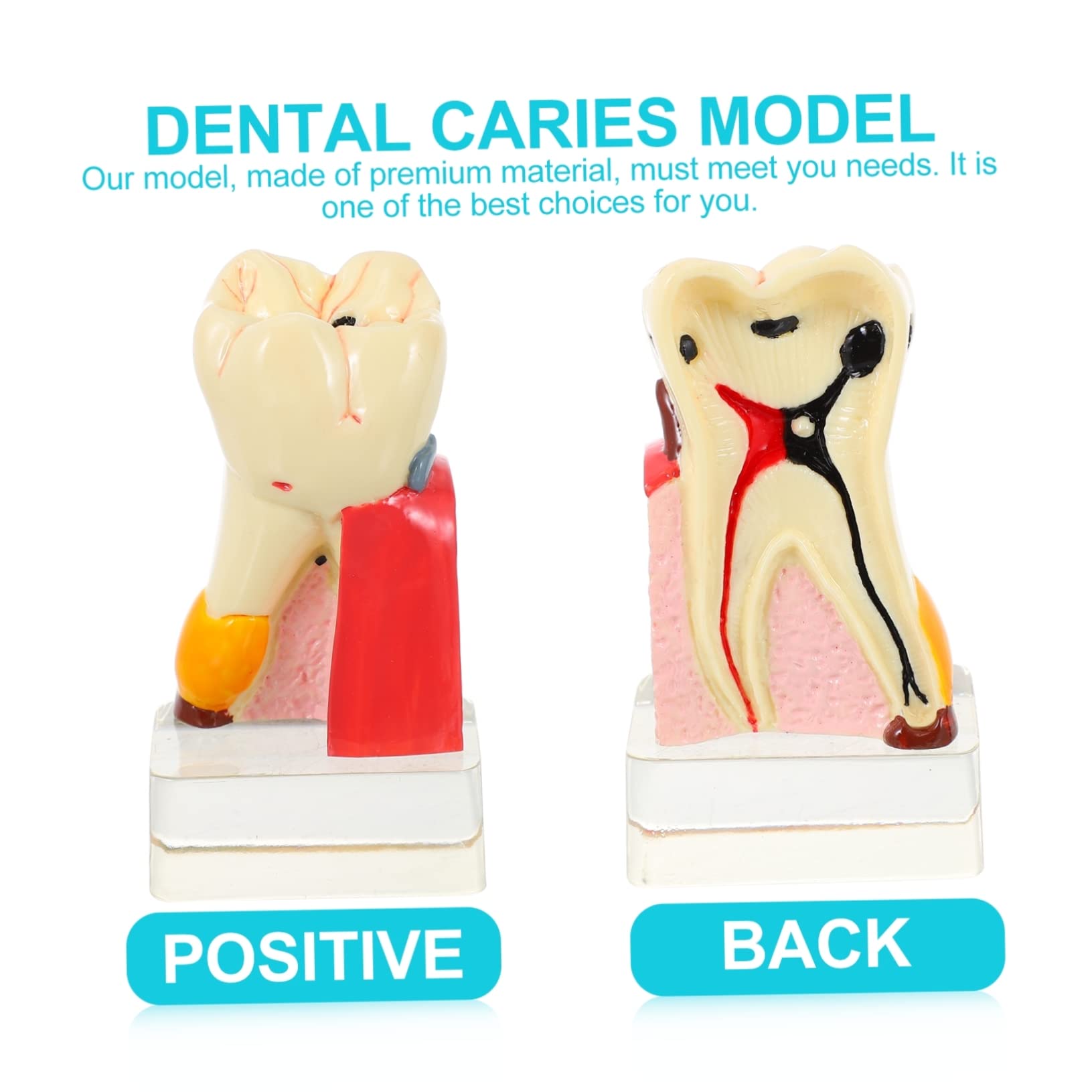Modello Denti Anatomico Didattico in Resina Beige per Demo | Portatile e Leggero, per Insegnamento Odontoiatrico, Modello Patologico per Studio e Presentazione