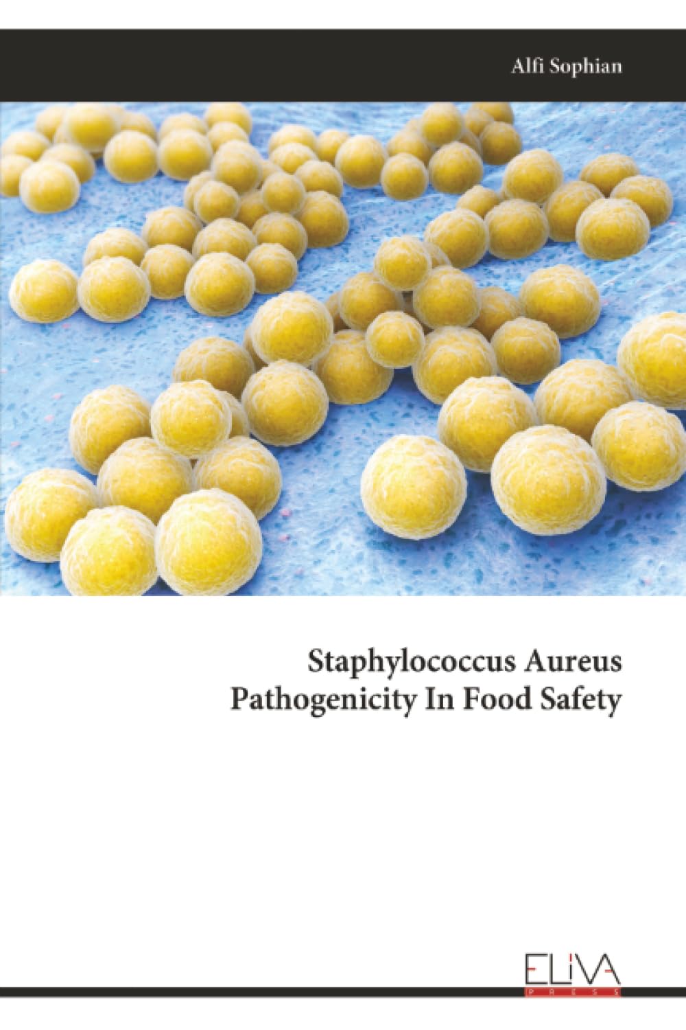 Staphylococcus Aureus Pathogenicity In Food Safety