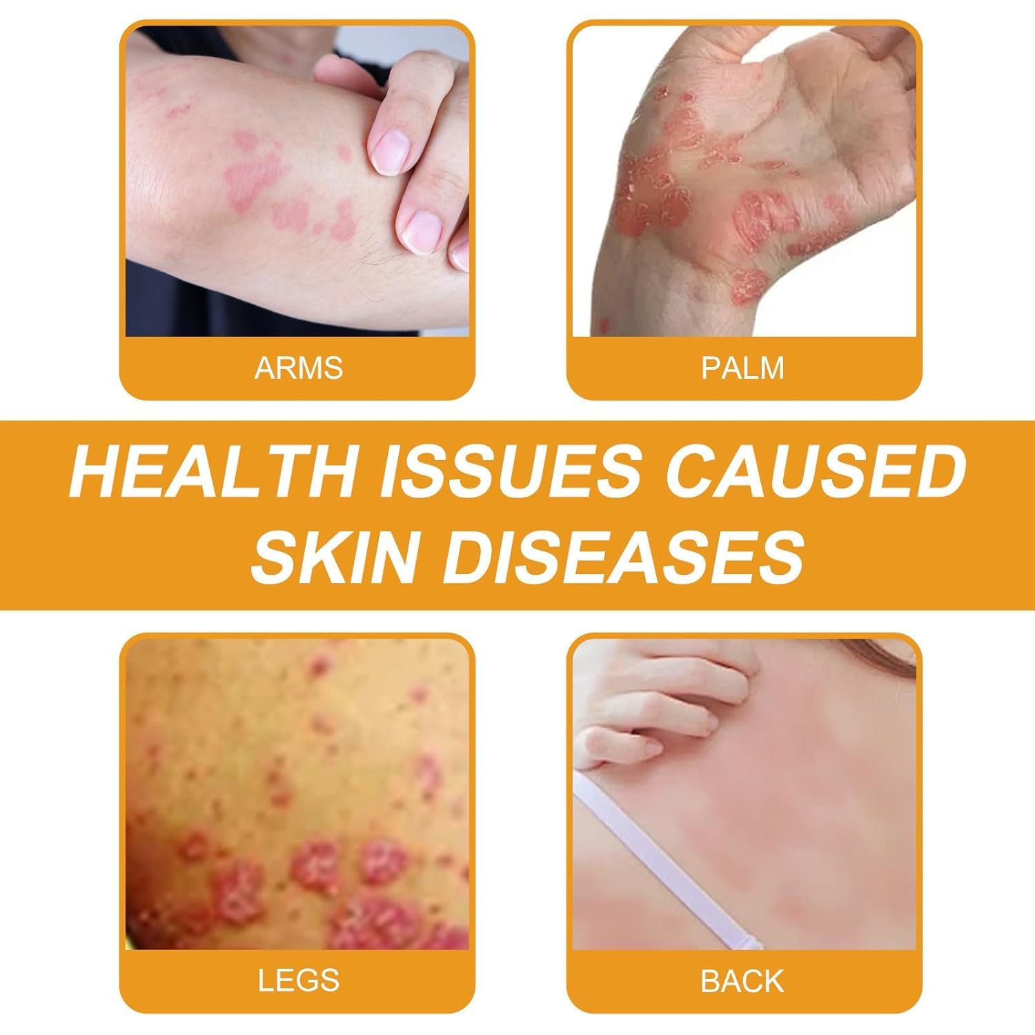 2PCS Bee Venom Cream for All Skin Treatment Bee Venom Repair Cream, Advanced Joint and Bone Cream for Neck Waist, Back, Hand - Image 4