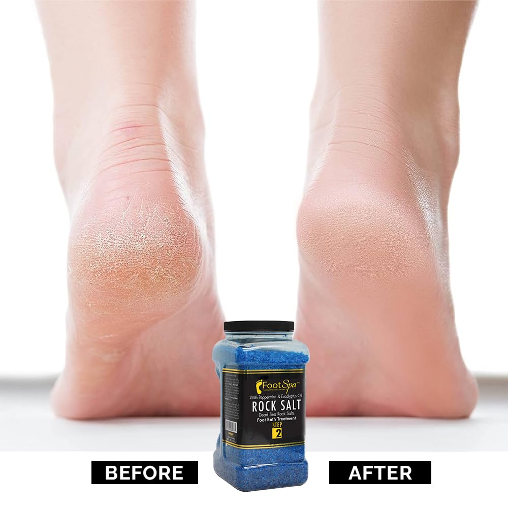 Detox Foot Soak Pedicura y sal de baño, 128 onzas - Fabricado con sales del mar muerto, eucalipto y aceite de menta - Hidrata, suaviza e hidrata 7