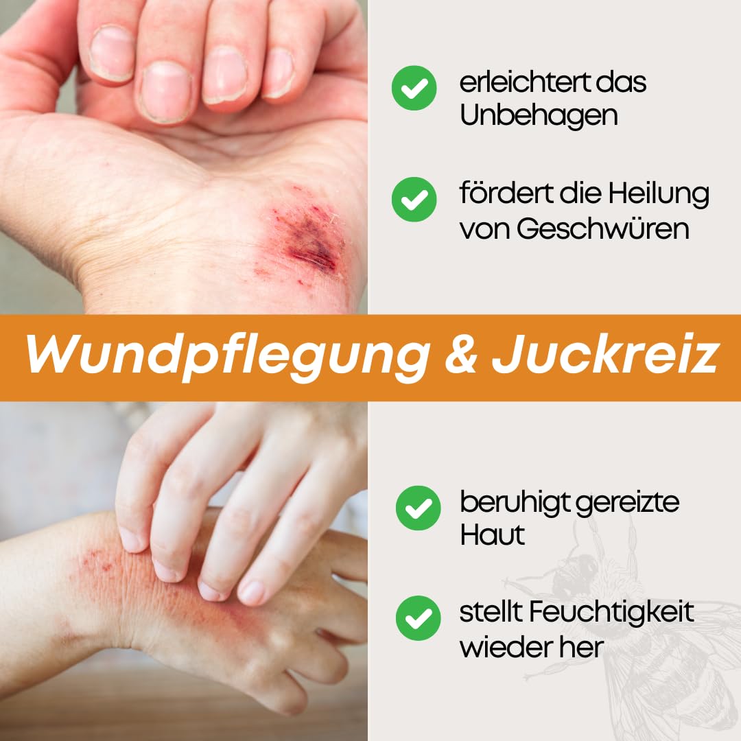 Zugsalbe & Wundsalbe 60g | Wund und Heilsalbe mit Calendula | Mighty Propolis Salbe | Wundheilsalbe | Salbe Gegen Juckreiz | Bee Enriched