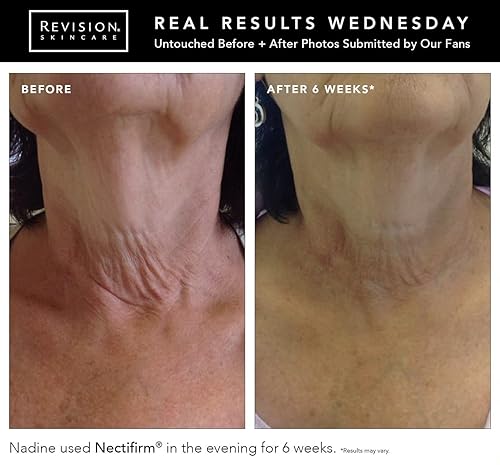 Miniatura 3 de Revisión Skincare necitfirm Tubo 8oz