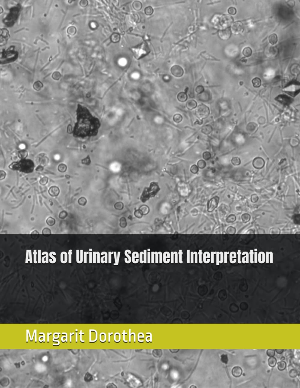 Atlas of Urinary Sediment Interpretation