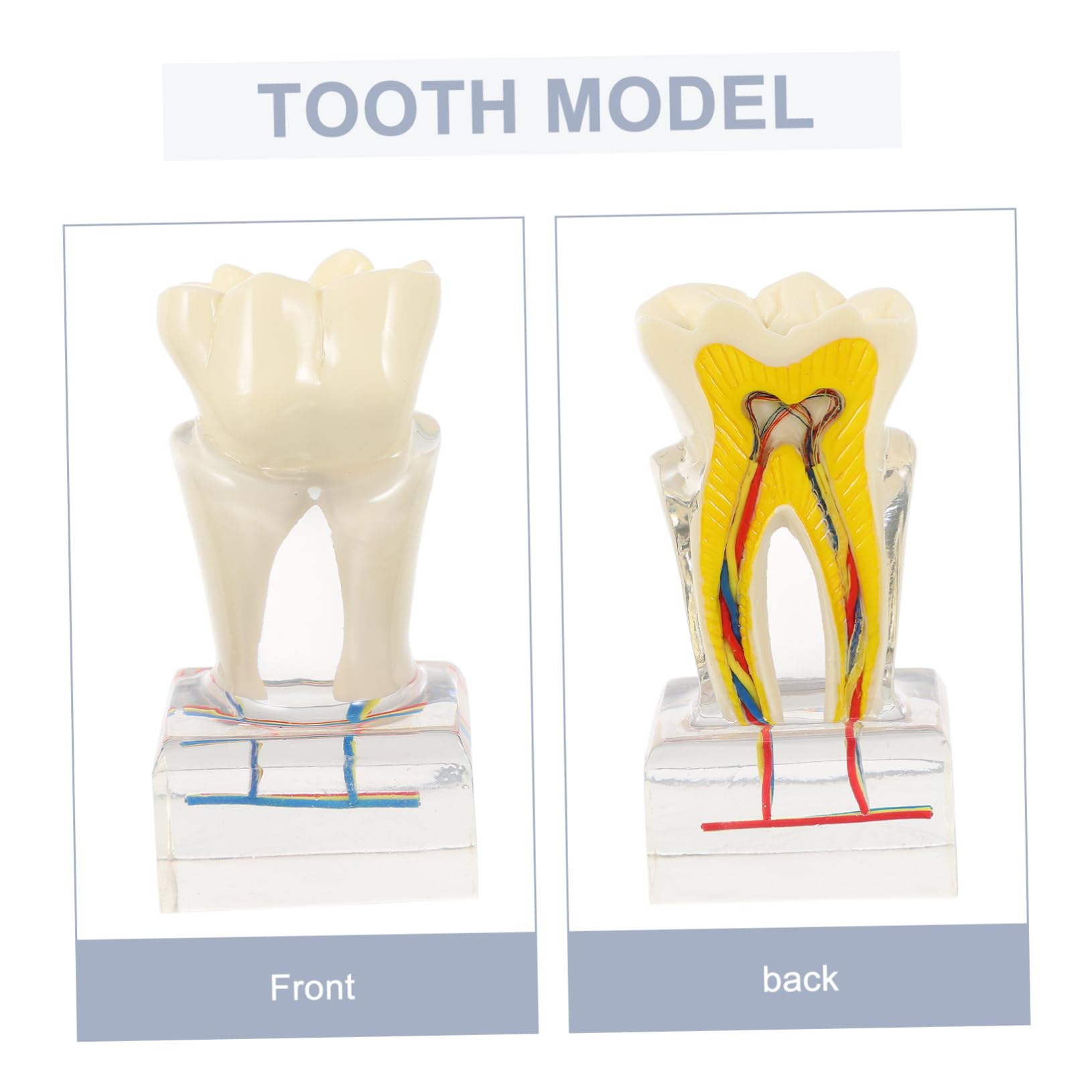 PRETYZOOM 6volte Modello Di Denti Dentali Modello Di Studio Per Per Lezioni Di Odontoiatria Dimostrazione Di Impianto e Protesi Fissa