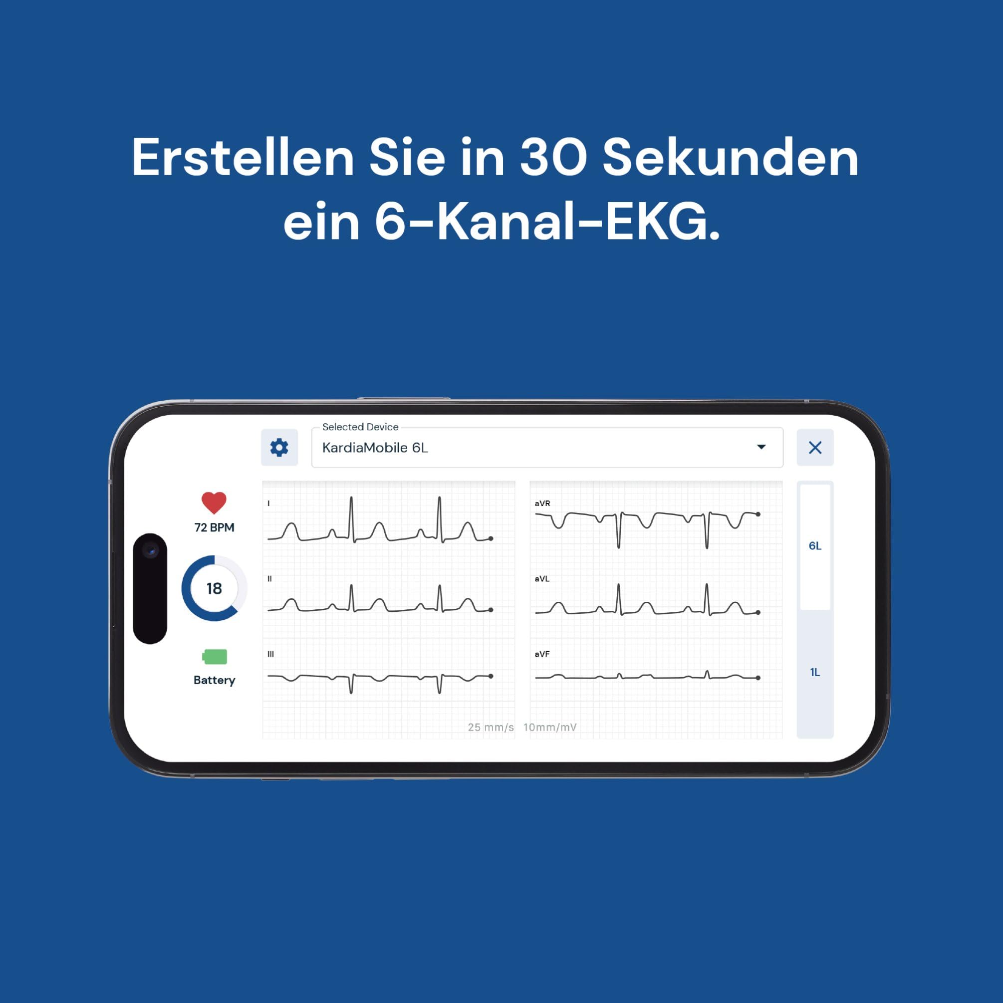 KardiaMobile 6-Kanal Personal-EKG Herzfrequenz-Monitor – Sechs Ansichten des Herzens, erkennt Vorhofflimmern, schnelle Ergebnisse