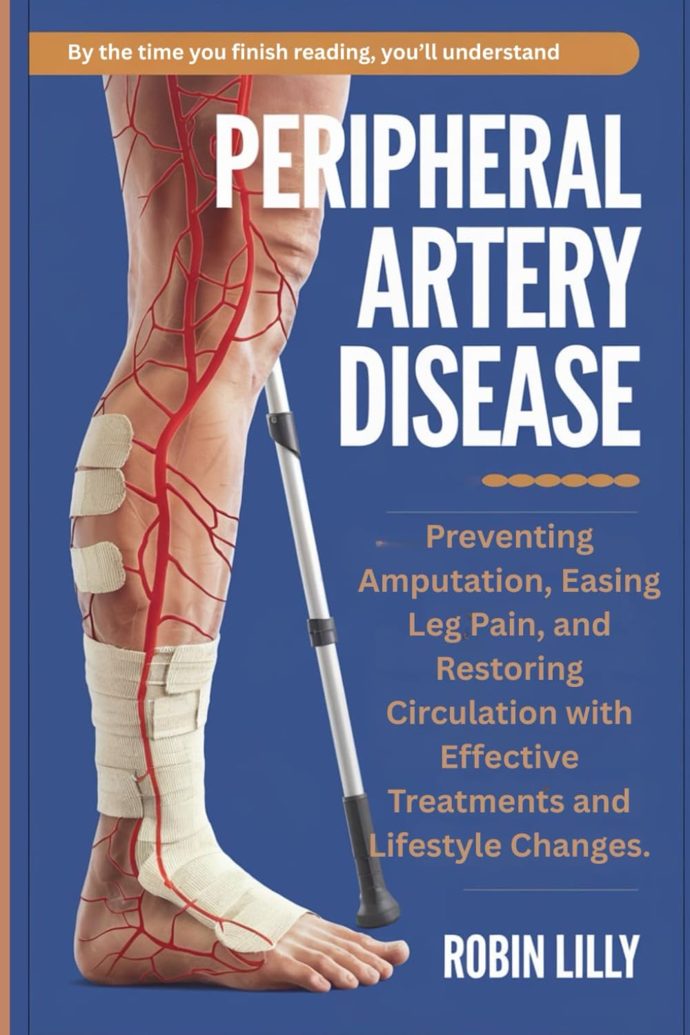 Peripheral Artery Disease: Preventing Amputation, Easing Leg Pain, and Restoring Circulation with Effective Treatments and Lifestyle Changes.