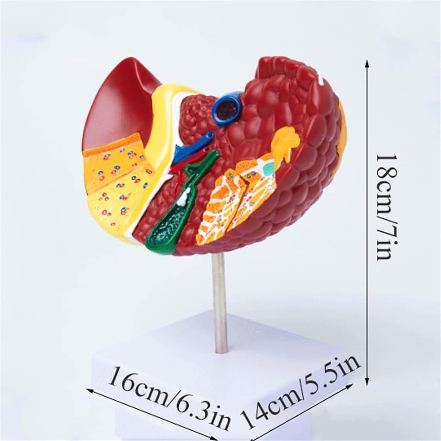 hixswnu Anatomowy model wątroby 3D do edukacji, patologiczna pomoc w nauce wątroby, wyposażenie biologiczne dla nauki, anatomii ludzkiej trzewnej do edukacji medycznej i pomocy w nauce