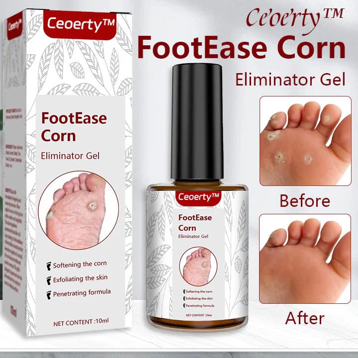 Image of BINGEABLE CornCare Foot Gel | Fast-Acting Corn & Callus Remover | Gentle Formula for Soft Feet | 30ml