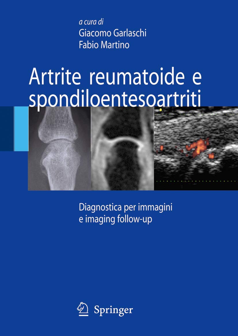 Artrite Reumatoide E Spondiloentesoartriti: Diagnostica Per Immagini Ed Imaging Follow-Up - 4