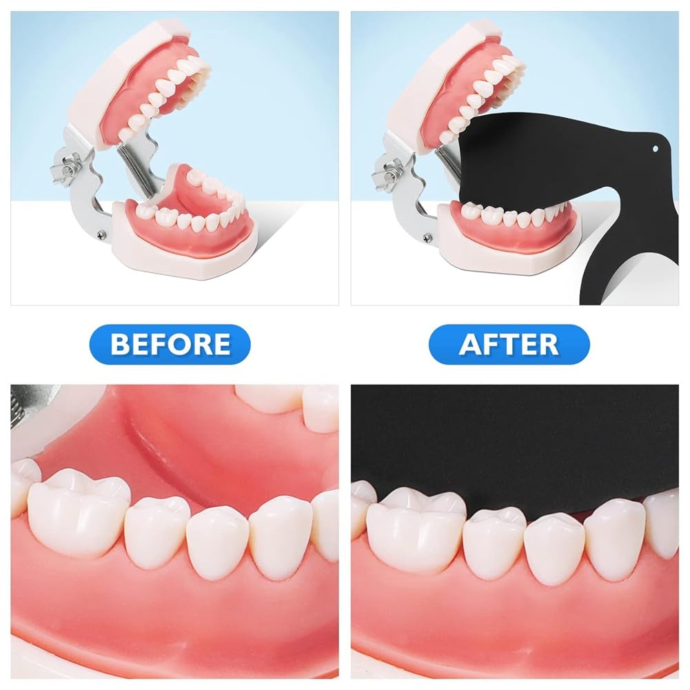 Kit de fotografía intraoral de contrastes dentales 6 piezas