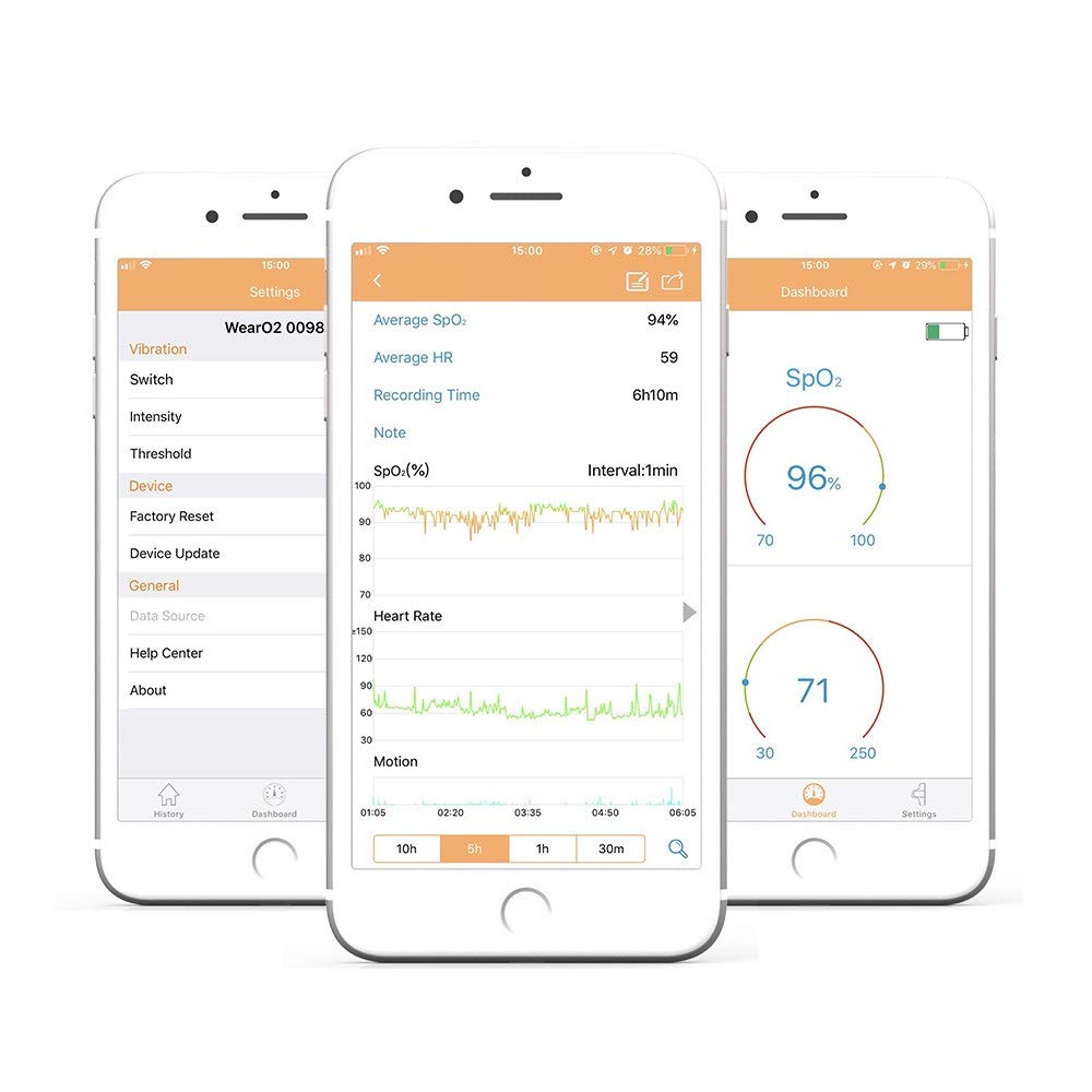 Portátiles oxímetro de Pulso Bluetooth con App vibración de Alarma for la Aptitud de Seguimiento hipóxico Monitor de Ritmo cardíaco