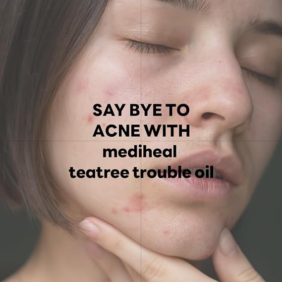 MEDIHEAL Teatree Trouble Calming Oil (0.33 fl oz), for Instant Soothing