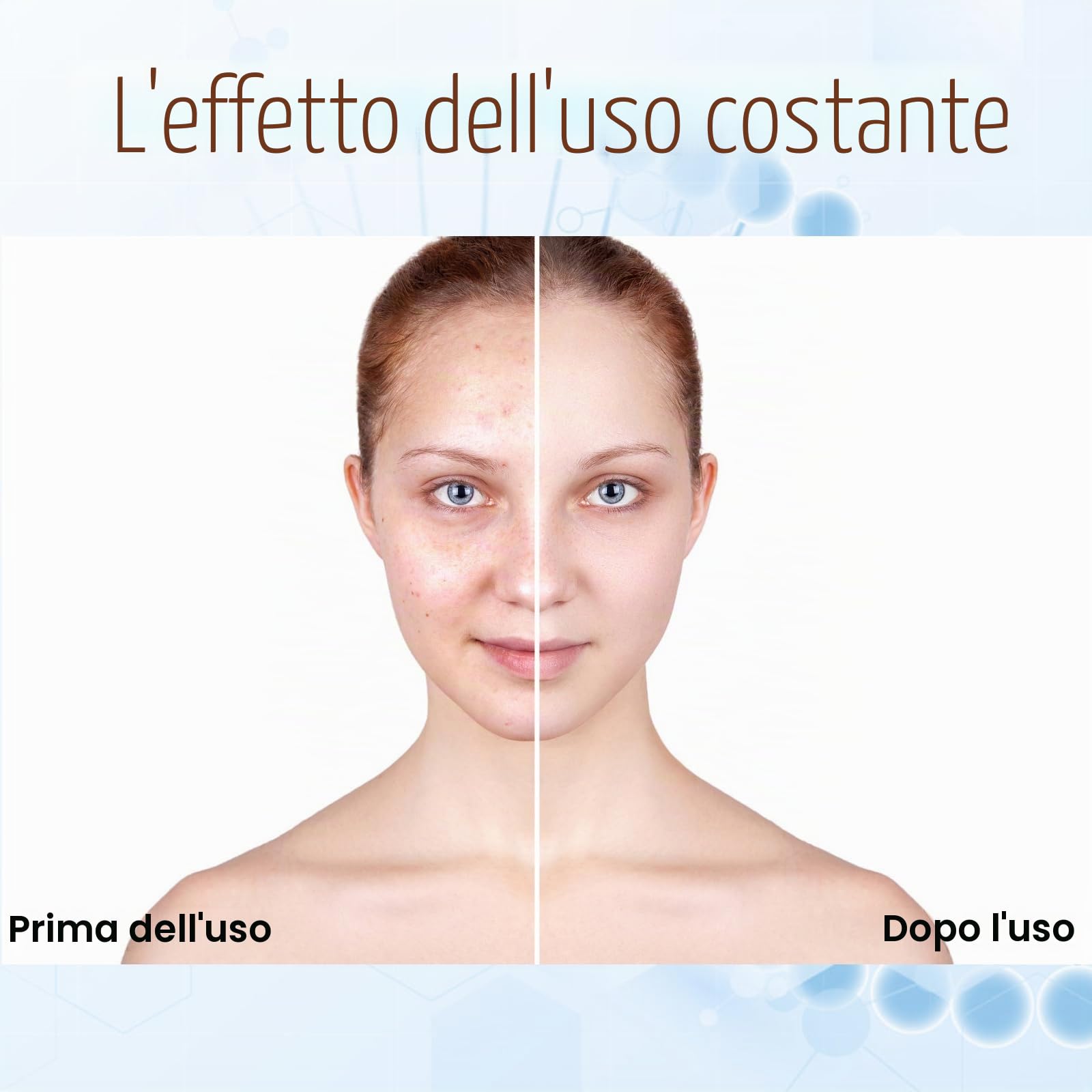 BB Facial Glow Starter Kit Siero all'acido ialuronico Essence per la cura della pelle | 8 ml, 12 pezzi, da utilizzare con balsamo per la pelle Microneedle (oro)