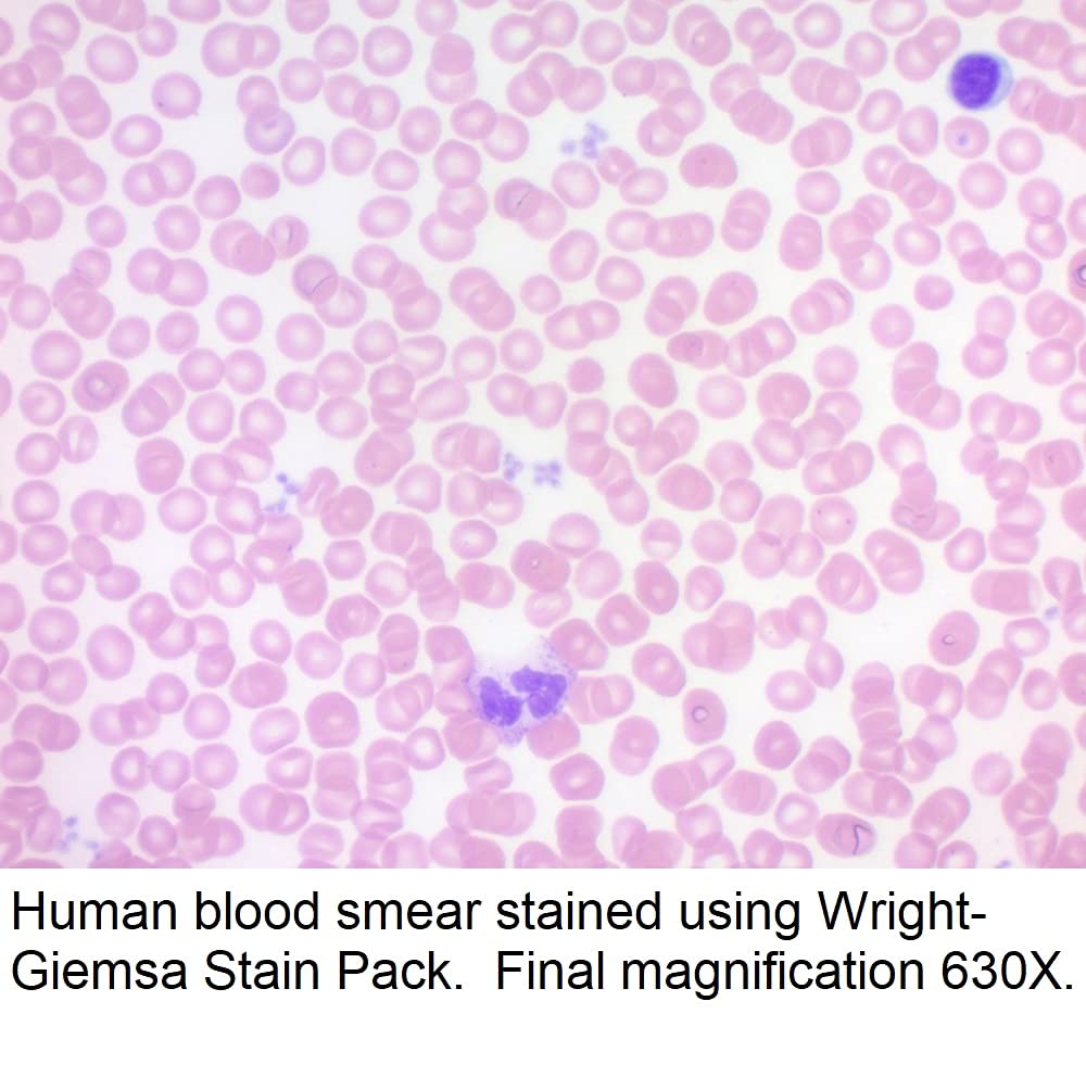 Wright-Giemsa Stain Pack, 500ml