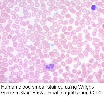 Wright-Giemsa Stain Pack, 500ml