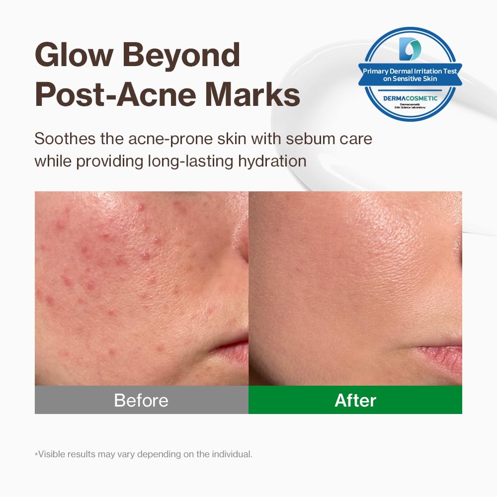 YUMU Cica Exosome Zinc Blemish Relief Cream, Face Moisturizer for Sensitive, Acne-Prone Skin, Lightweight, Breakouts, Barrier Repair, Hydration, Soothing, Oil-Free, Korean Skincare (80 ml/2.70 fl.oz.) - Image 2