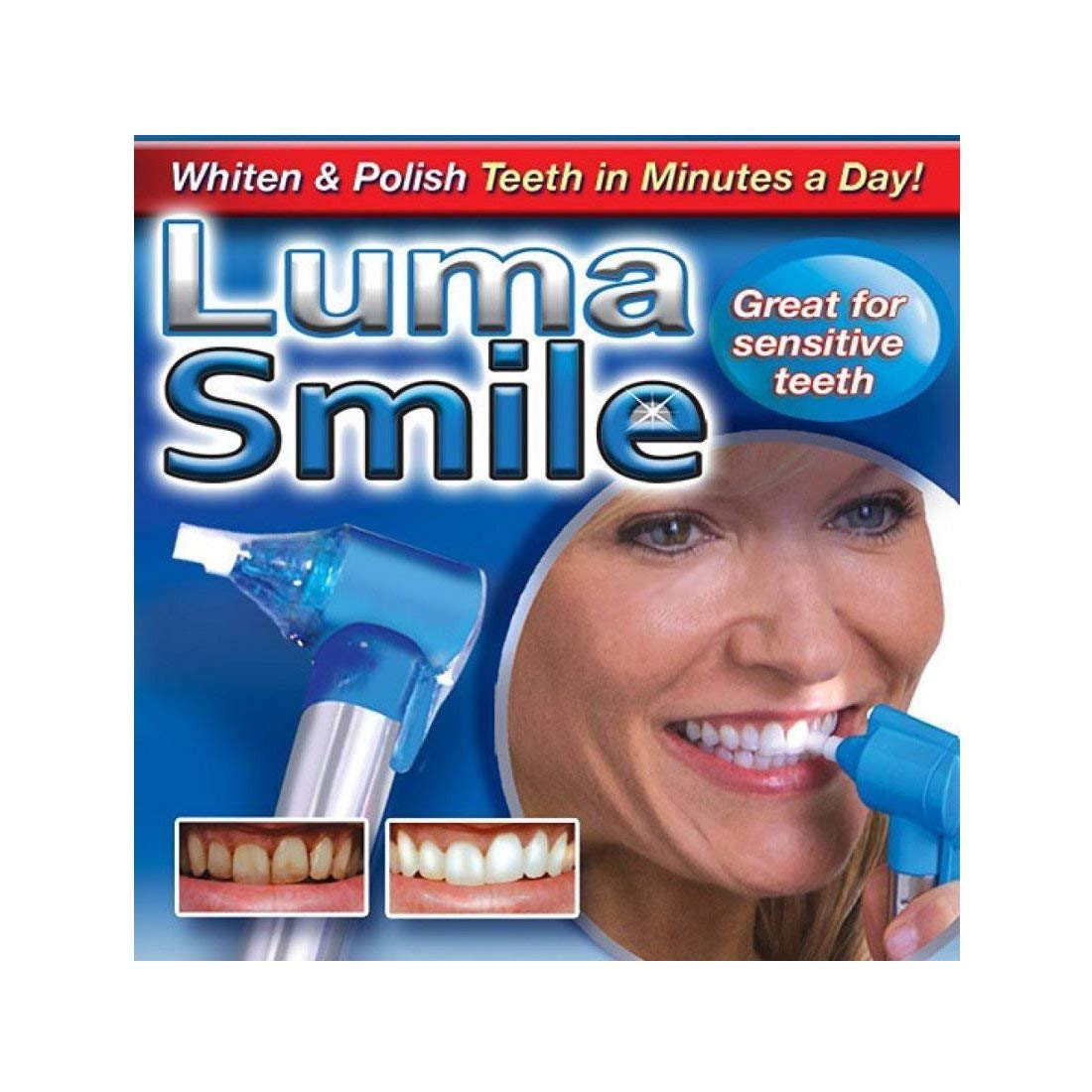 STORE Tooth Polisher Whitener Stain Remover with LED Light luma Smile Rubber with extra 4 Cups 4