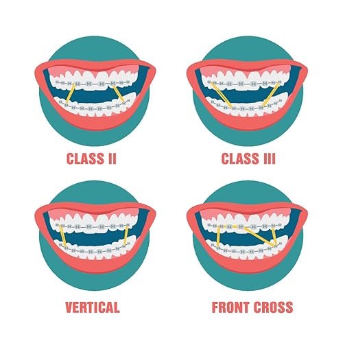 Miniatura 4 de Elásticos intraorales de ortodoncia – 10 bolsas x 100 piezas – Mediano 1/8 pulgadas 4.5 oz – 0.126 in, látex quirúrgico – 1000 piezas, material