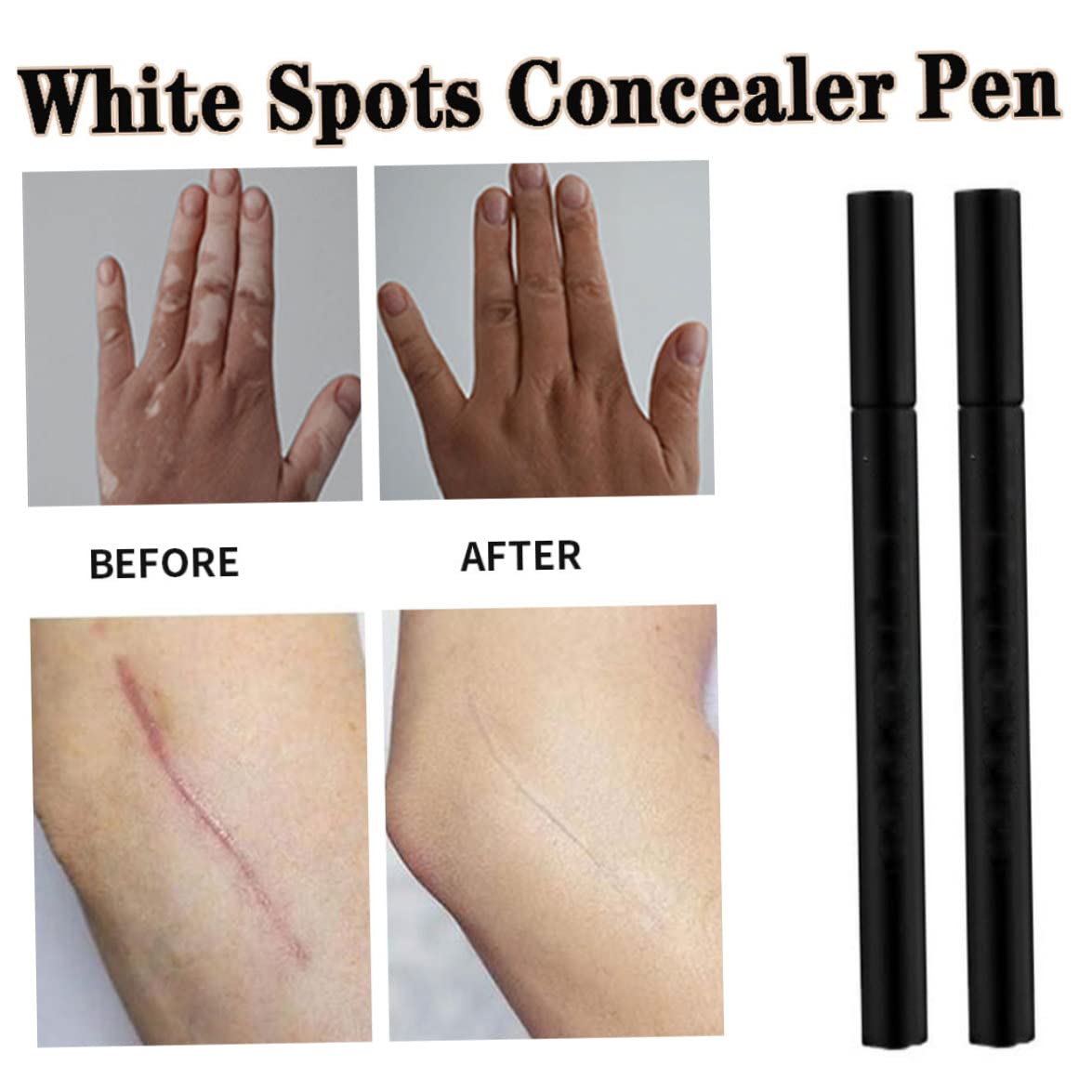 Concettore bastoncino correttore macchie bianche penna trucco vitiligine