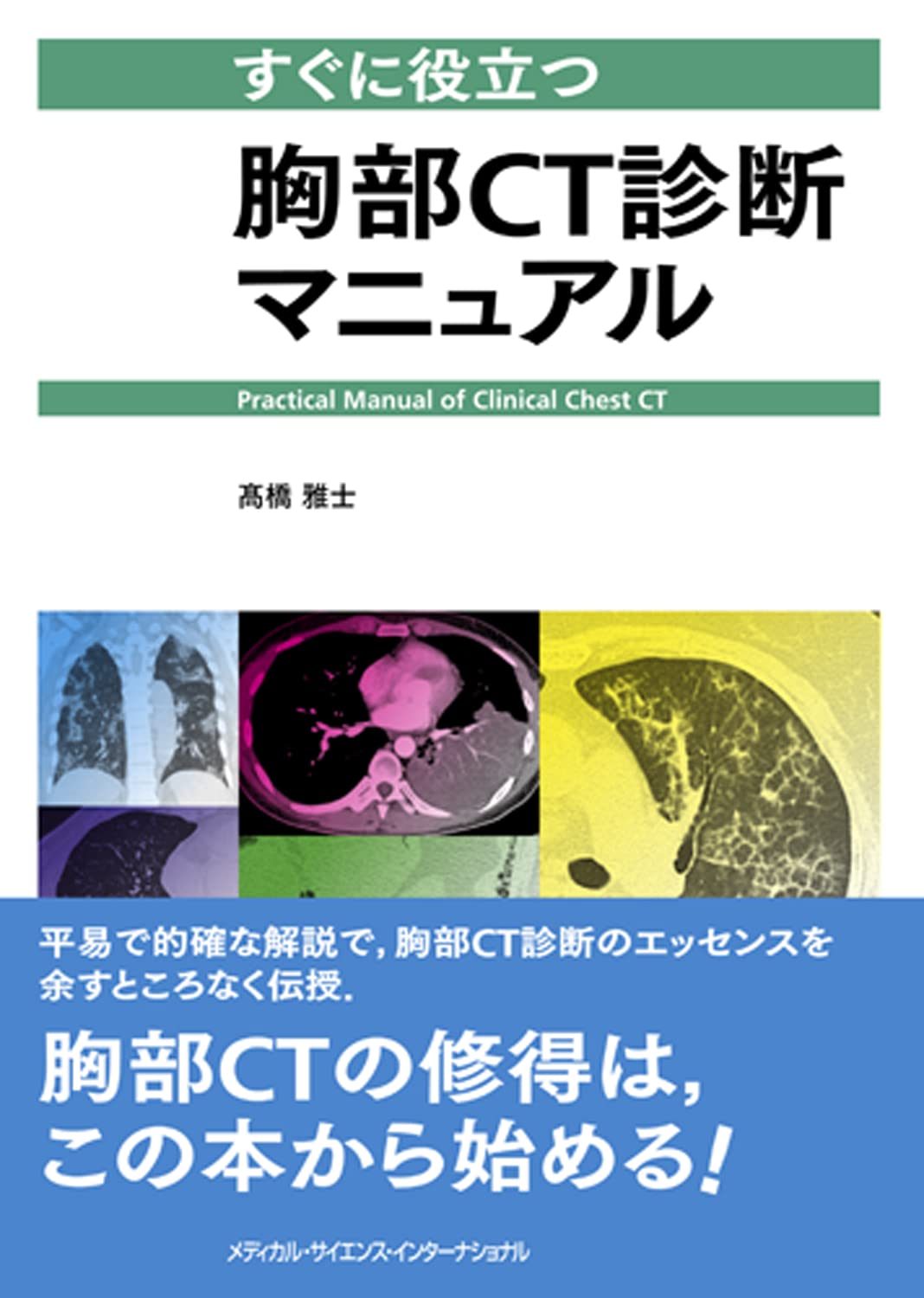 胸部CT・MRIマニュアル 1 61y-yK8-tAL.jpg