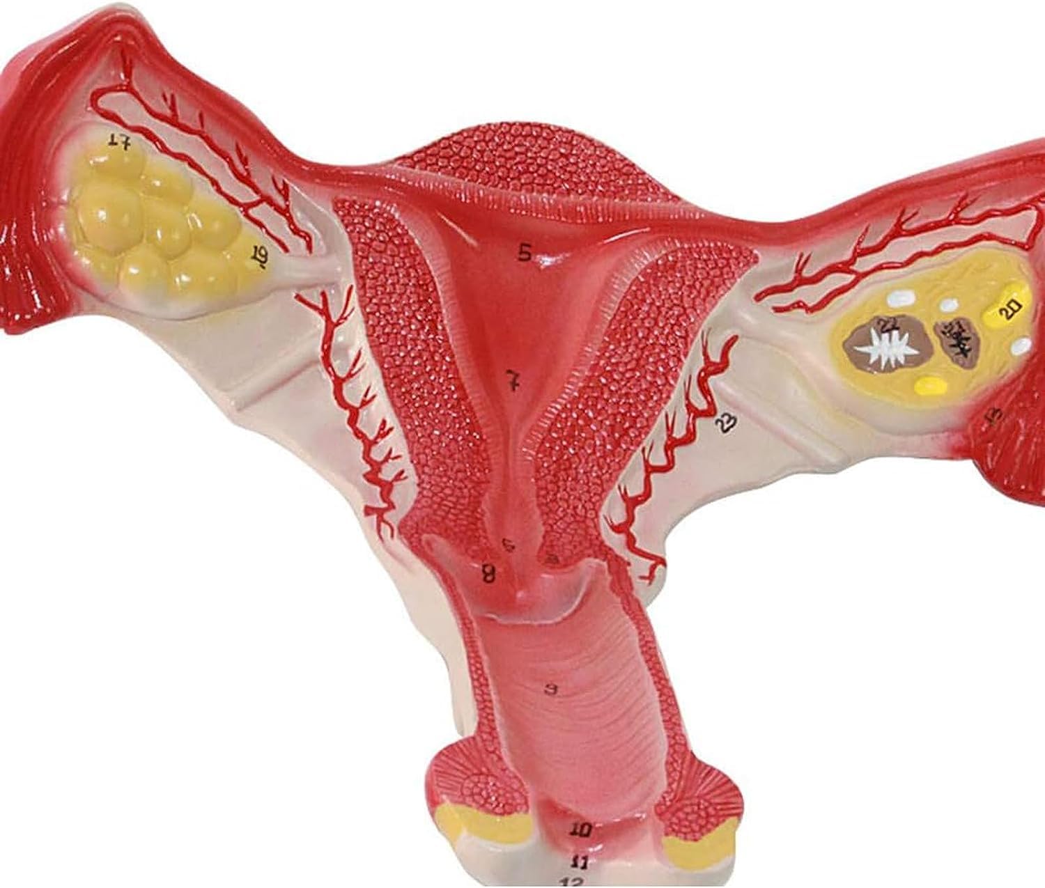 Modelo anatómico de anatomía, lesión uterina, Modelo de anatomía de órganos Humanos con órganos extraíbles para la enseñanza, Aprendizaje y exhibición de órganos.